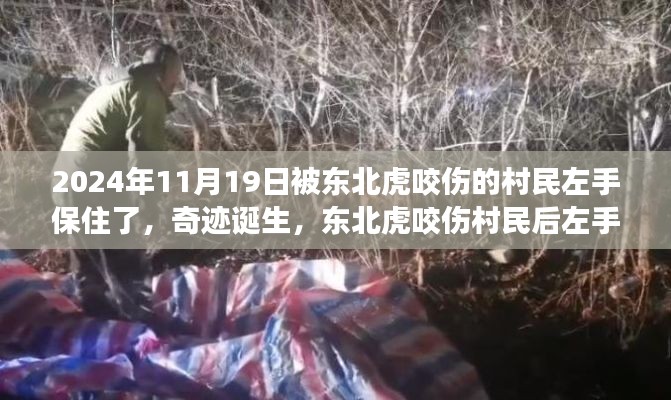 東北虎咬傷村民后奇跡誕生，左手成功保住