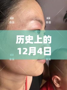 革命性雀斑最新技術(shù)誕生，重塑美顏新紀(jì)元，歷史上的十二月四日里程碑式突破