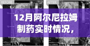 阿爾尼拉姆制藥12月實時動態(tài)，生產(chǎn)進展、市場洞察一覽無余