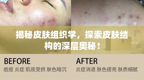 揭秘皮膚組織學(xué)，探索皮膚結(jié)構(gòu)的深層奧秘！