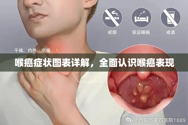 喉癌癥狀圖表詳解，全面認識喉癌表現(xiàn)