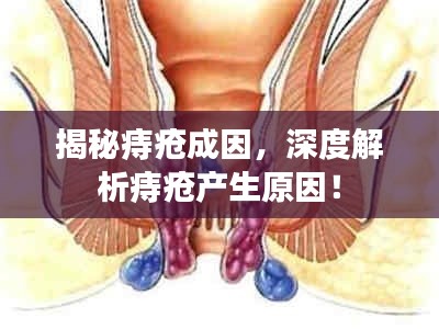 揭秘痔瘡成因，深度解析痔瘡產(chǎn)生原因！