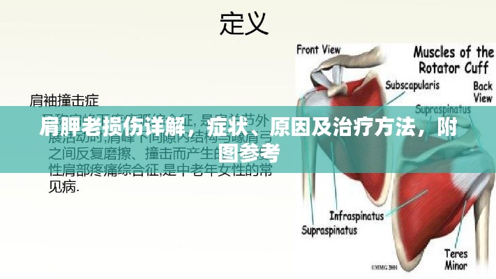 肩胛老損傷詳解，癥狀、原因及治療方法，附圖參考