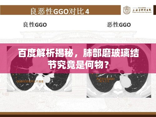 百度解析揭秘，肺部磨玻璃結(jié)節(jié)究竟是何物？