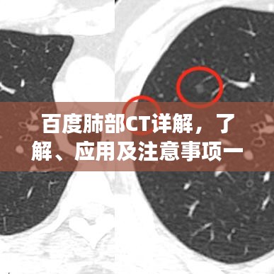 百度肺部CT詳解，了解、應(yīng)用及注意事項一網(wǎng)打盡