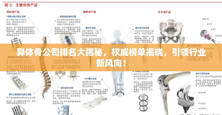 異體骨公司排名大揭秘，權(quán)威榜單揭曉，引領(lǐng)行業(yè)新風(fēng)向！